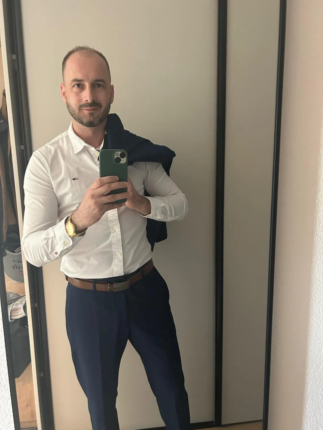 Klient pred transplantáciou vlasov